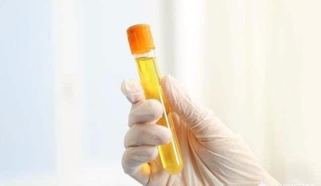 体内尿酸过高,这4种食物是大忌,否则痛风一直好不了