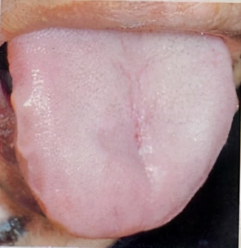 口干口苦口臭怎么回事?怎么治疗?中医辩证论治效果可靠安全