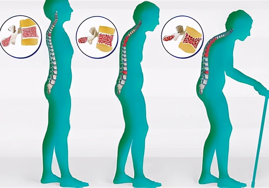 50岁后感到身体疲乏、疼痛,这种痛苦谁能理解?医生为您讲清楚