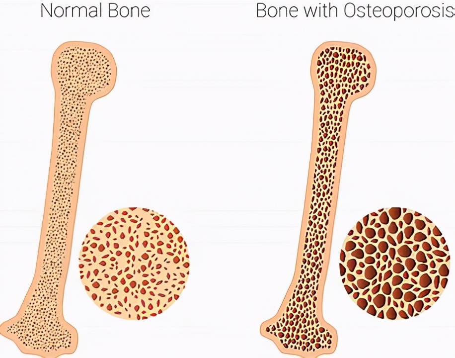 50岁后感到身体疲乏、疼痛,这种痛苦谁能理解?医生为您讲清楚