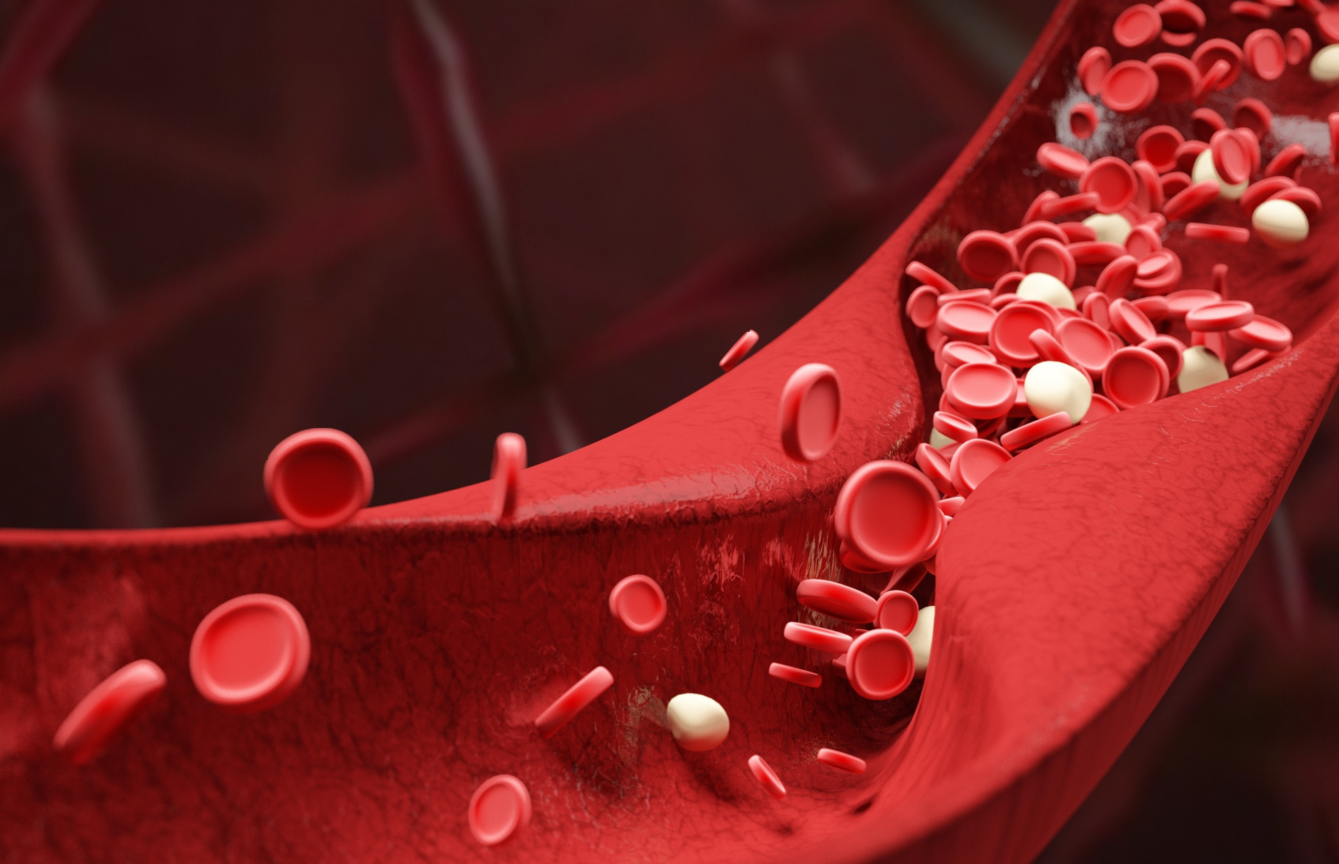 降血脂，阿托伐他汀和瑞舒伐他汀如何选？不同情况，选择各不同