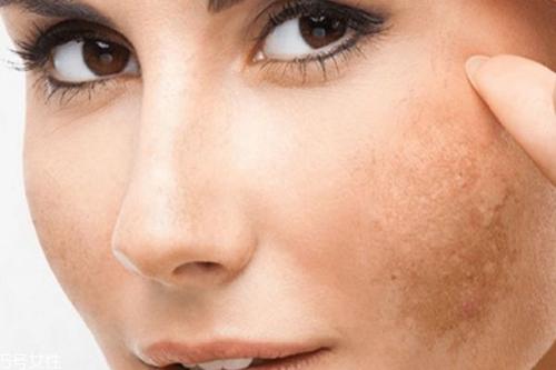 缺乏黄体酮的女性，身体或许会给出这几个信号，应及时进行调理