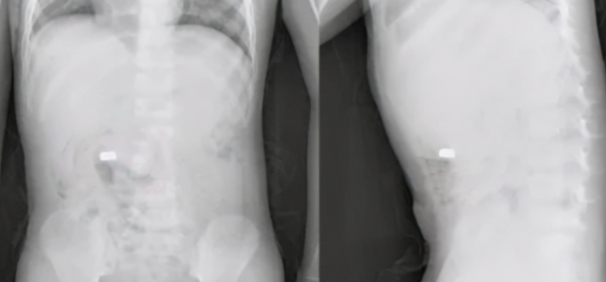 “妈妈我肚子里能长出钱”，话刚说完，宝妈就带娃直奔医院