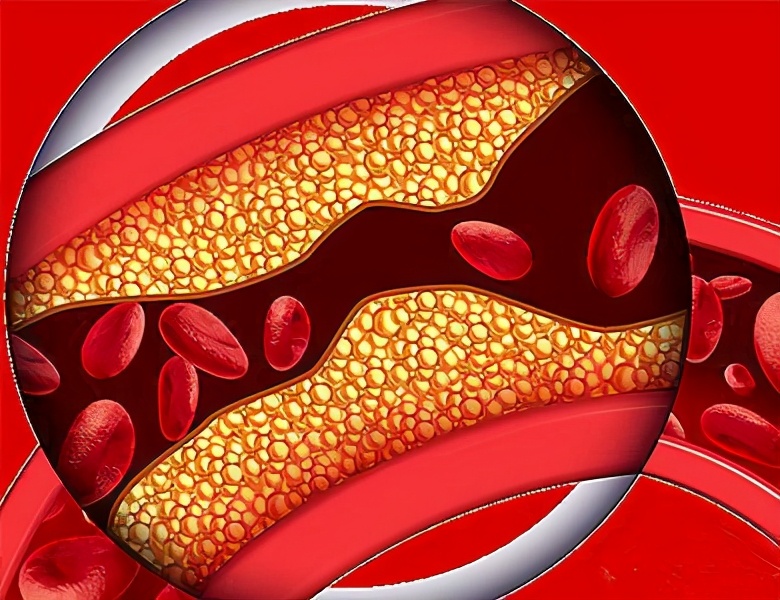 中老年人要防心脑血管病,别吃肉为好?医生:要看是什么肉