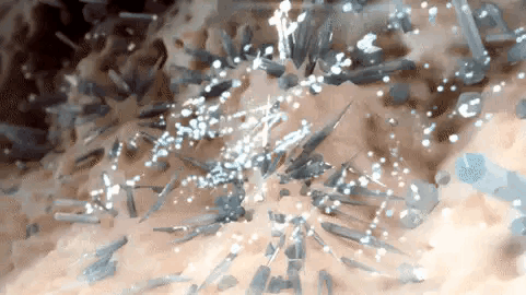 医生辟谣:体内的尿酸只有20%来自于食物,所以控制饮食没有用