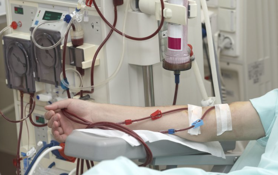 尿毒症多是“吃”出来的?这4种食物少碰,肾会感激你