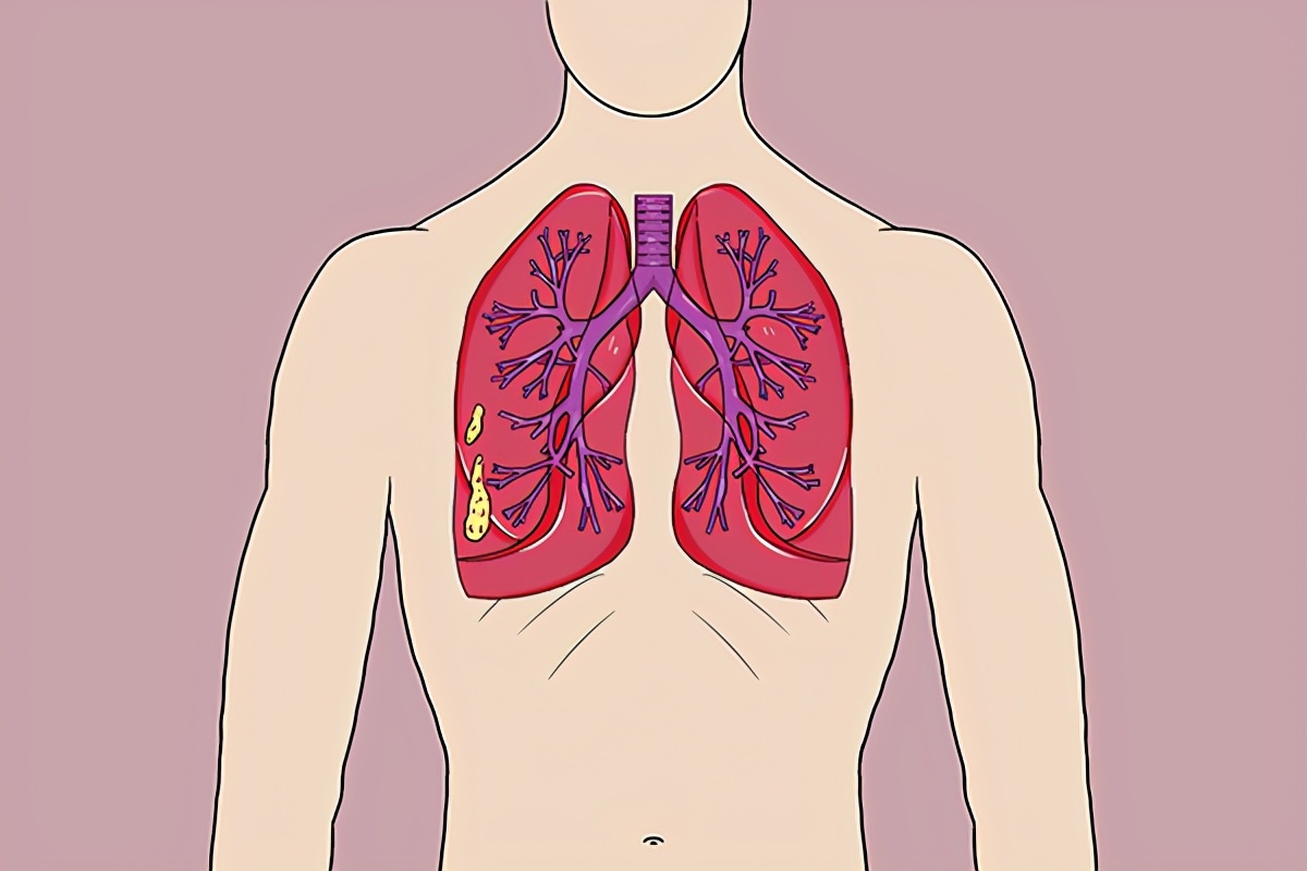 指甲上出现竖纹,是咋回事?月牙的多少,与健康有关?