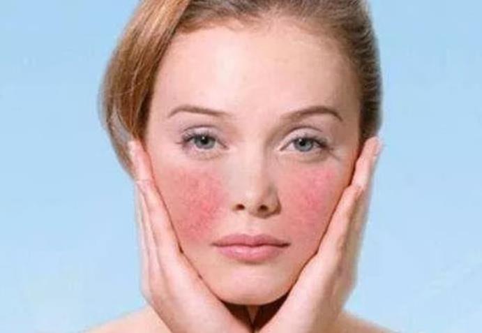 如果皮肤科医生自己过敏了,她会这么做......