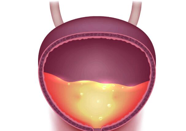 上了年纪的人,经常失眠睡不着,夜尿频繁?或是3个原因惹的祸