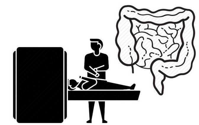 肠癌发出的第一个信号,别再当成小病对待,4类人越早查肠镜越好