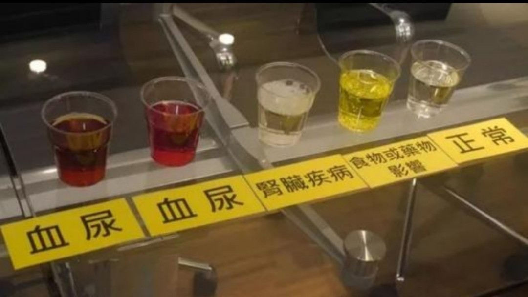 一喝水就想排尿,说明肾脏好还是不好?医生:教你3点科学判断