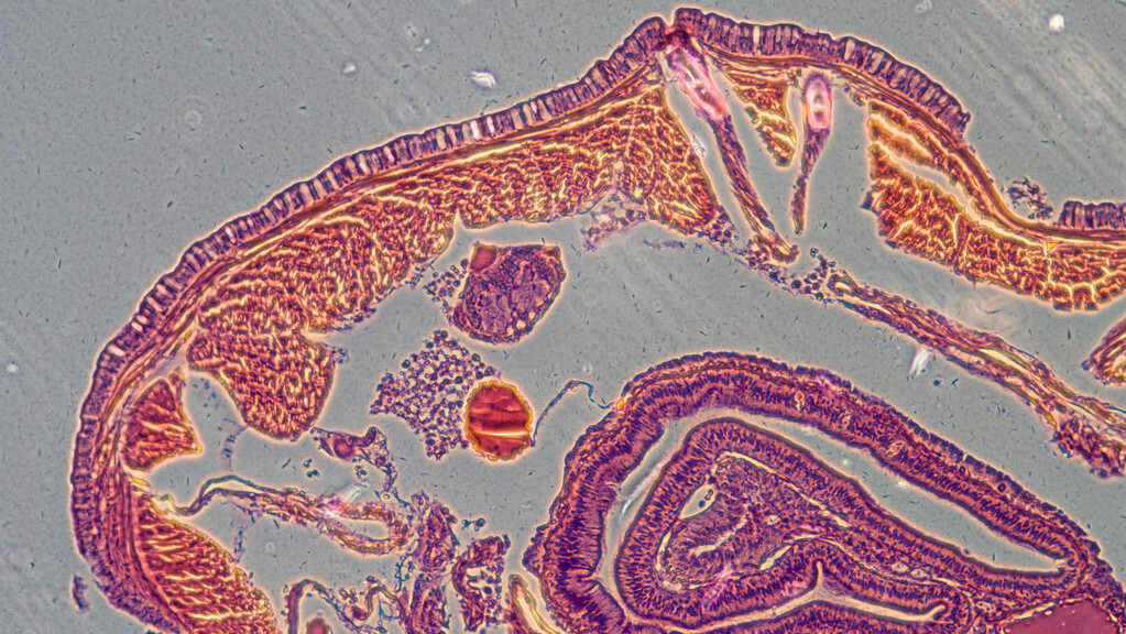 早晨起床后,口苦口臭?除了肝火旺盛,还有这个原因,容易被忽视
