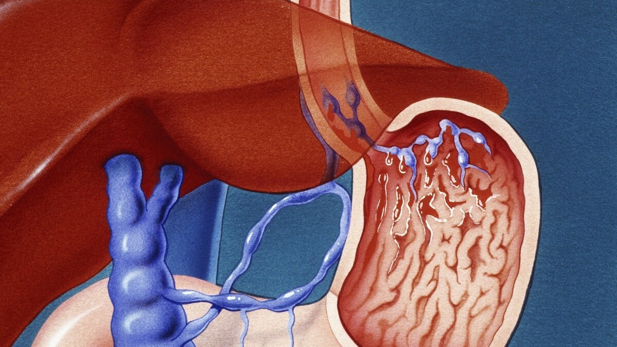 早晨起床后,口苦口臭?除了肝火旺盛,还有这个原因,容易被忽视