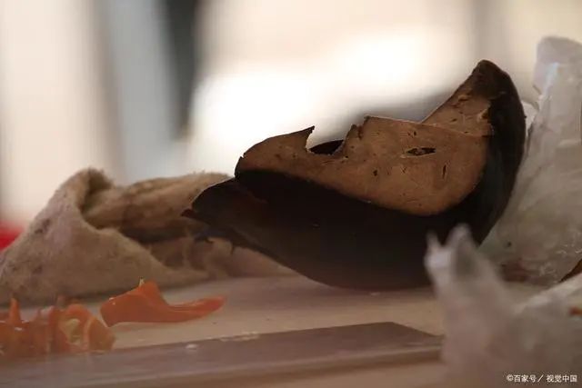 不想与肾结石“纠缠不休”?做2事,排出结石,肾会感激你