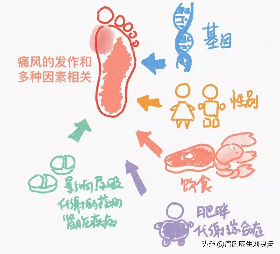 痛风是吃出来的病？尿酸高还是喝出来、累出来、懒出来和胖出来的