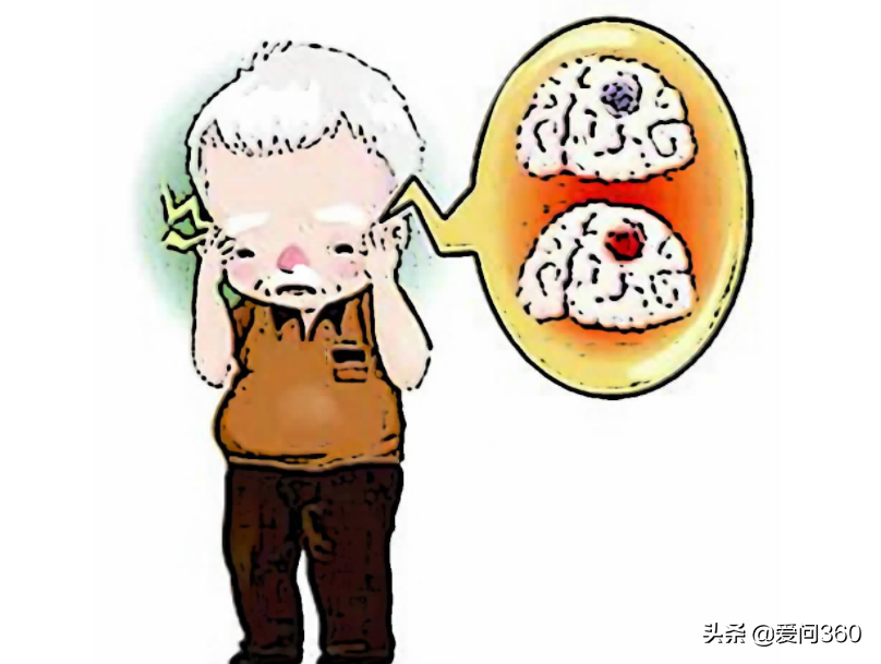 四个原因能导致大脑衰退,6个方法可以减缓老年痴呆的几率