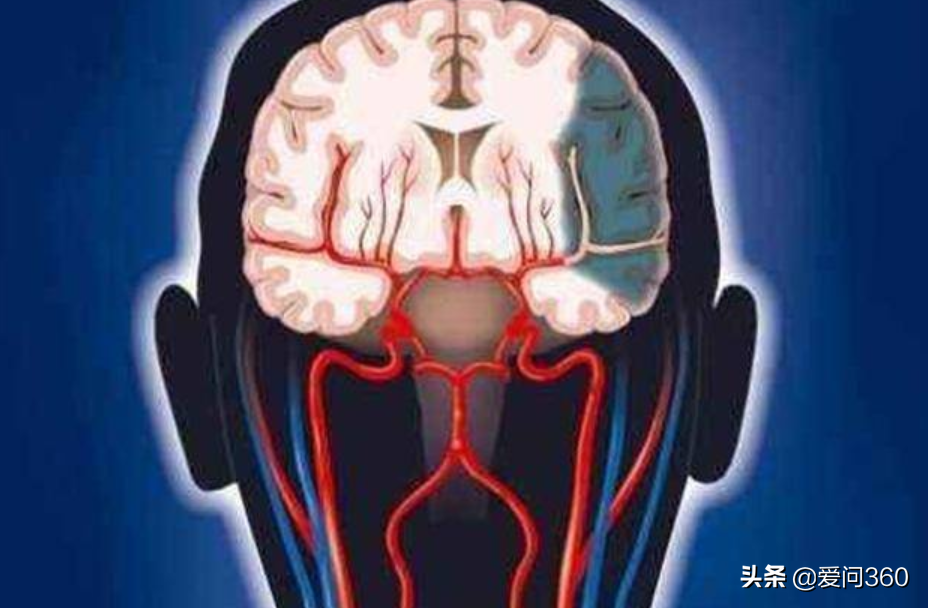 四个原因能导致大脑衰退,6个方法可以减缓老年痴呆的几率