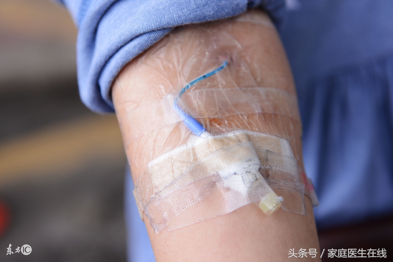 中年人最该预防这两种病,专家:做到这8点,80岁也能身体健康