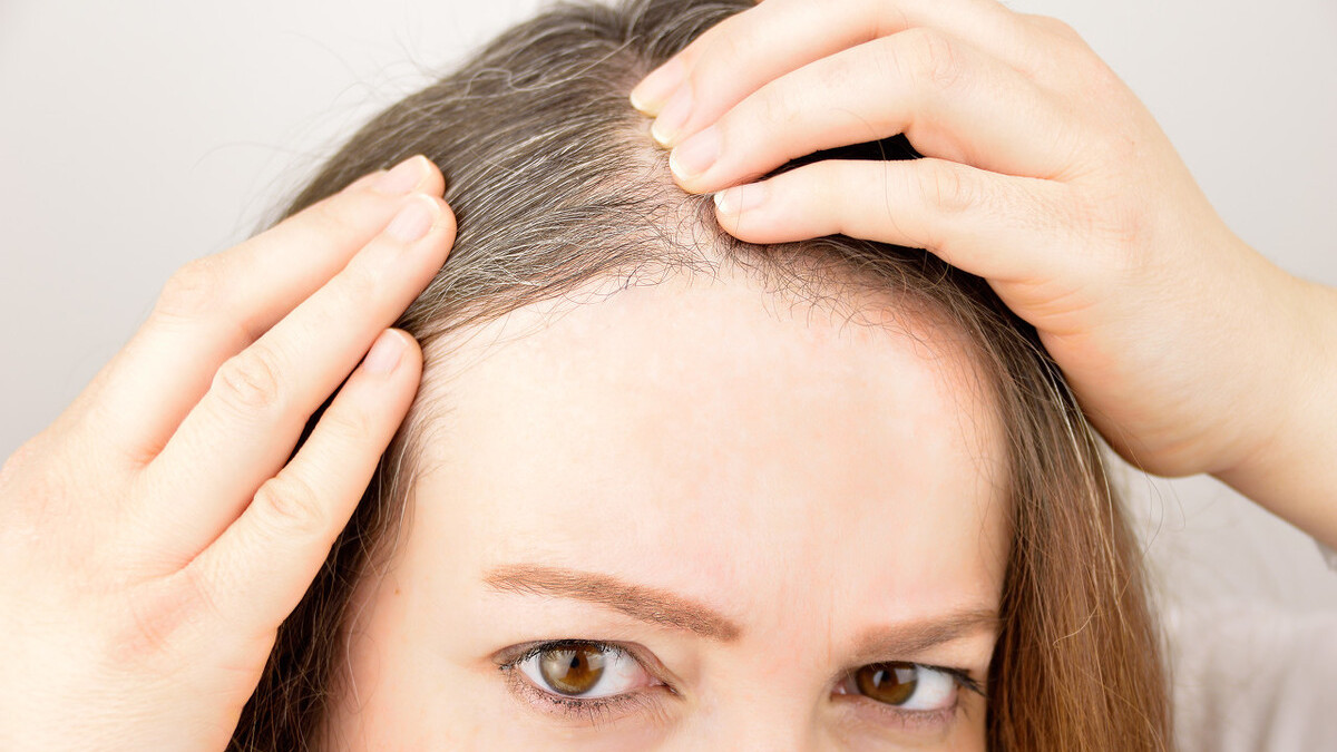 白发长在不同位置,对应不同“脏腑”问题,对照检查,及时调理