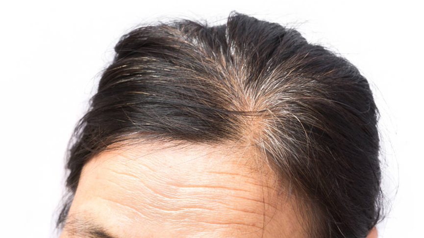 白发长在不同位置,对应不同“脏腑”问题,对照检查,及时调理