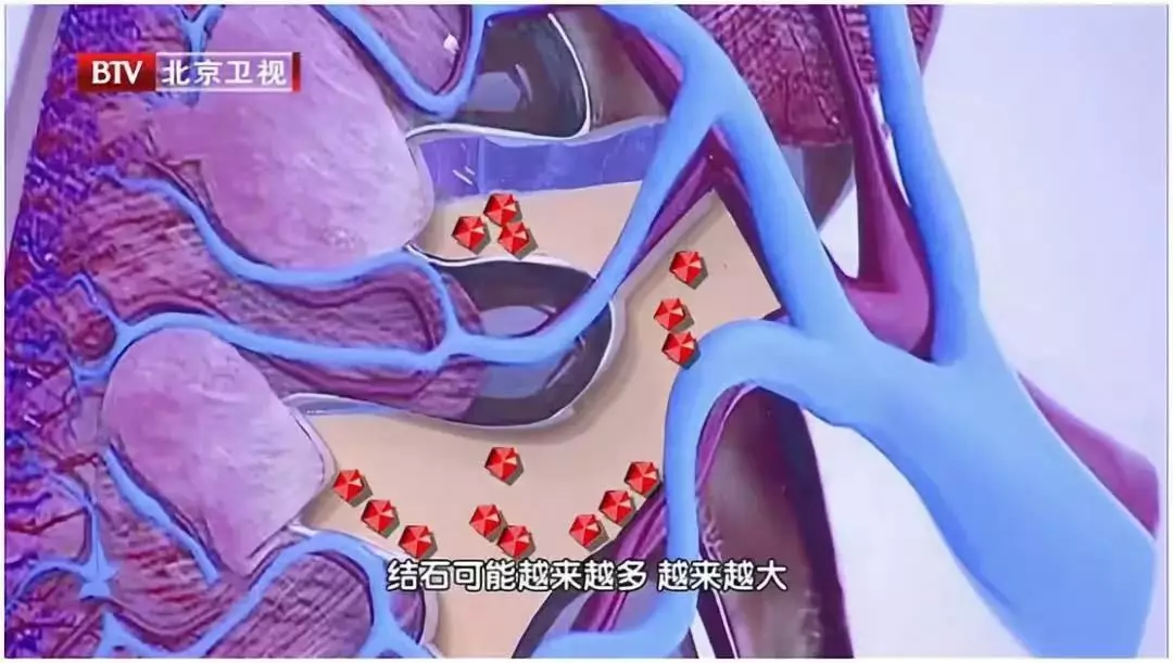 多喝水,到底是养肾还是伤肾?专家表示:不同阶段,讲究的也不同