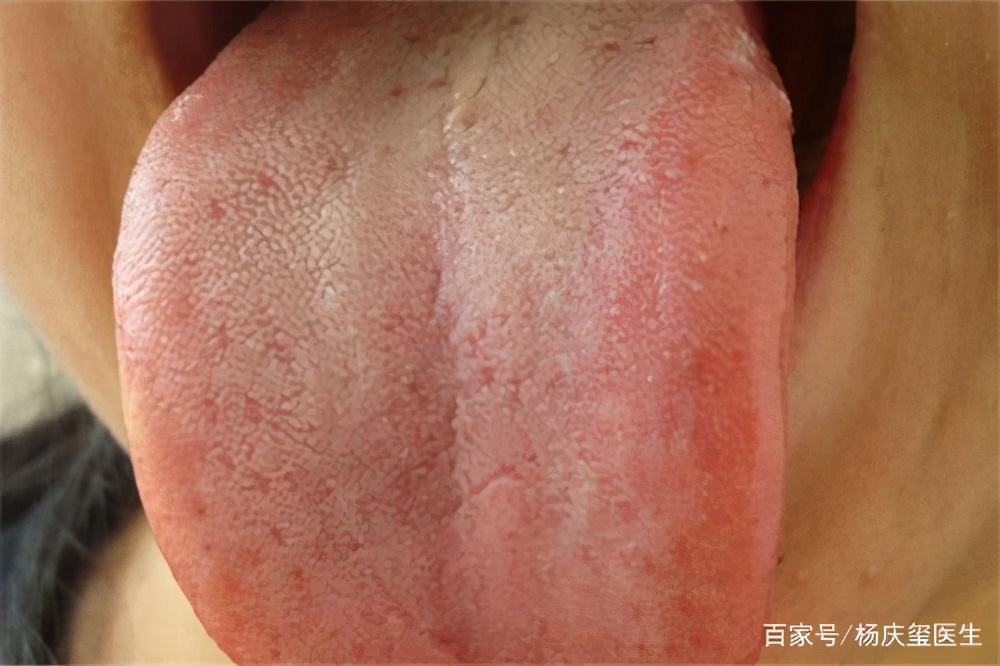 肝脏是否健康,看嘴能知晓?嘴里若有3种异常,或许要养护肝脏了